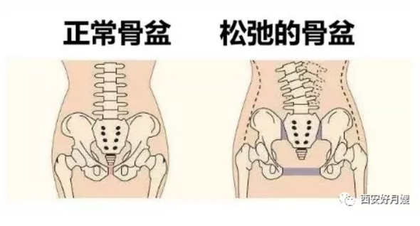 西安产后康复培训-不容错过丨产后修复的最佳时机，你掌握了吗？