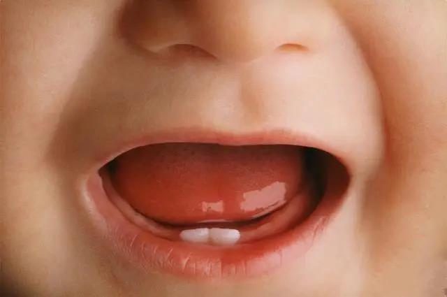 西安育儿嫂哪家好?新手宝妈的疑惑：宝宝9个月还没出牙算晚吗?